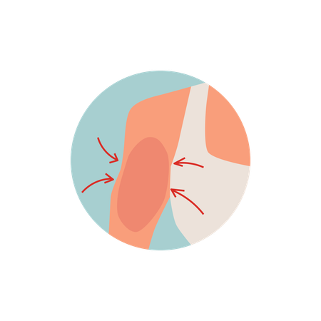 Plastic surgery design  female shoulder  Illustration