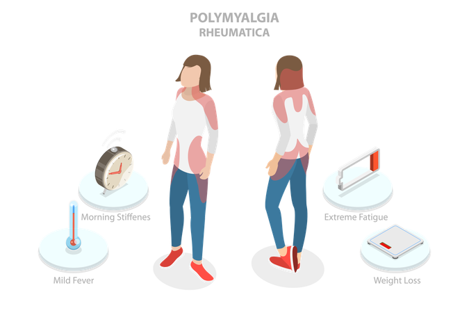 Polymyalgia Rheumatica  Illustration