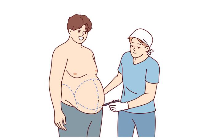 Preparación para la liposucción para hombre gordo que quiere deshacerse del exceso de peso y la flacidez del vientre.  Ilustración