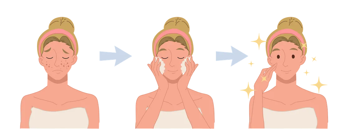 Procedimento de tratamento facial claro  Ilustração