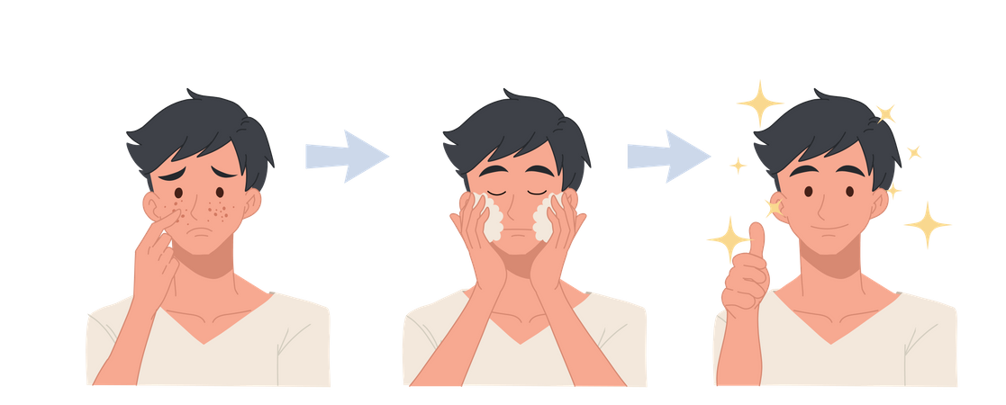 Procedimento facial para tratamento de acne  Ilustração