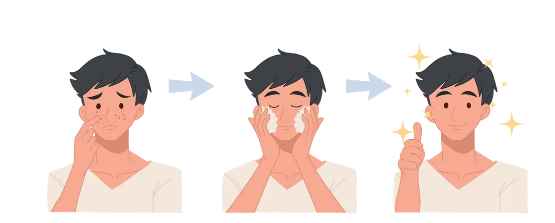 Conceito De Cuidados Com A Pele Tratamento De Acne Antes E Depois Espuma De Limpeza Facial Cuidados Com A Pele Masculina Ilustracao De Desenho Animado Vetorial Plano Ilustração