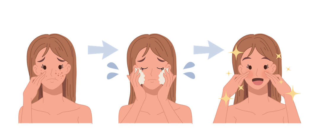 Proceso de tratamiento del acné para un rostro claro.  Ilustración