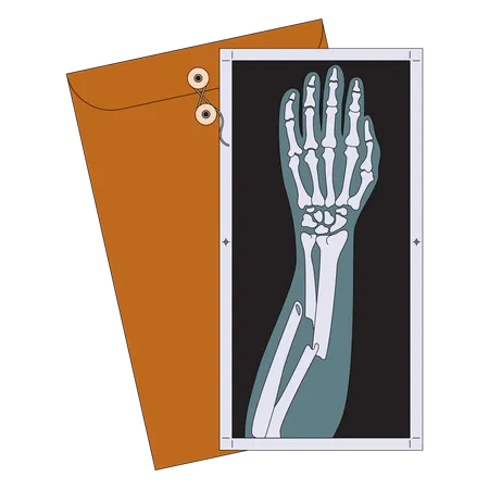 Radiografia de braço quebrado  Ilustração