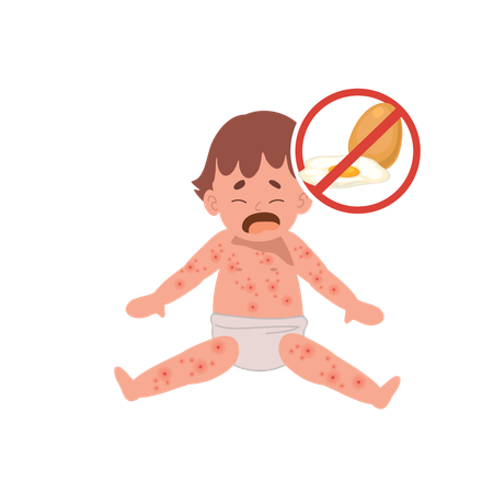 Reações alérgicas em bebês  Ilustração