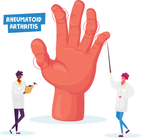 Rheumatoide Arthritis  Illustration