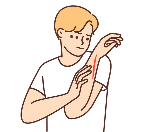 Sangrado en la mano  Ilustración