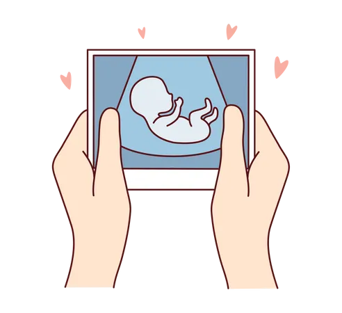 Bild einer schwangeren Gebärmutter  Illustration