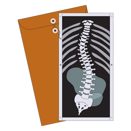 Radiographie de la scoliose  Illustration