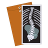 illustrations for scoliosis