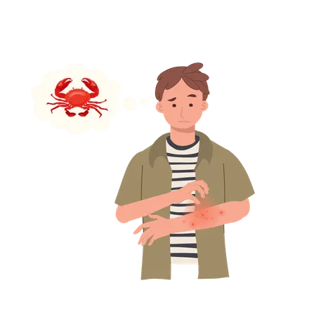 Seafood Allergy Reaction Man With Itchy Red Rash On Arm Allergic Skin Problem From Crab Illustration