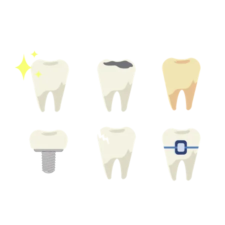 Set of teeth with different types of dental diseases  Illustration