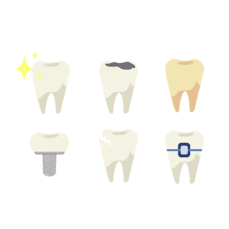 Dental Health Concept Set Of Teeth With Different Types Of Dental Diseases Implant Caries Tartar Bridge Flat Cartoon Vector Illustration Illustration