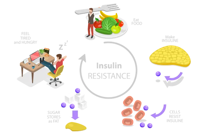 Ilustracion Conceptual De Vector Plano Isometrico 3 D Del Sindrome De Resistencia A La Insulina Mala Respuesta Del Higado A La Insulina Ilustración