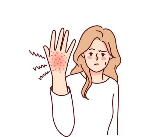 Skin allergy  Illustration