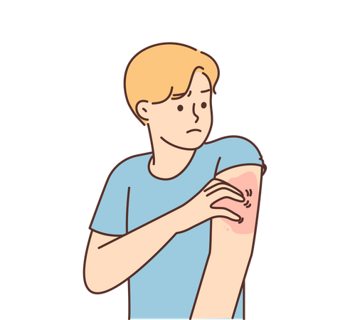 Skin allergy  Illustration