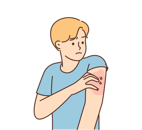 Skin allergy  Illustration