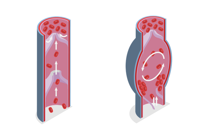 Skin layer diagram  Illustration