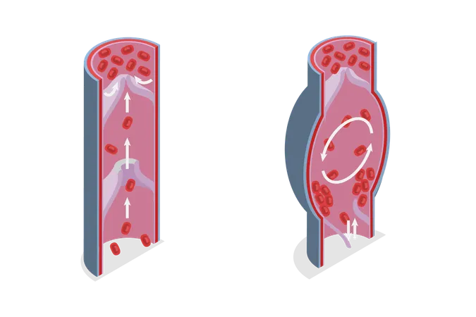 Skin layer diagram  Illustration