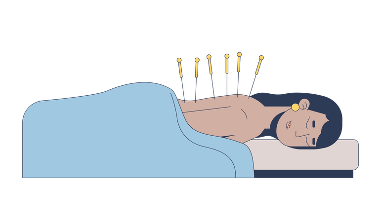 South asian woman receiving acupuncture therapy  Illustration