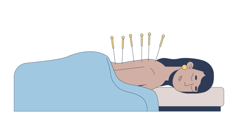 South asian woman receiving acupuncture therapy  Illustration