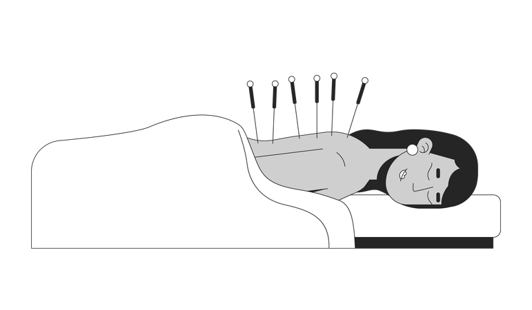 South asian woman receiving acupuncture therapy  Illustration