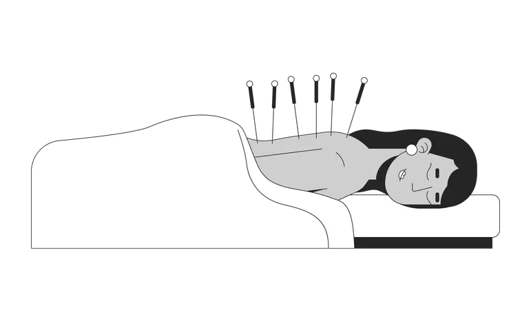 South asian woman receiving acupuncture therapy  Illustration