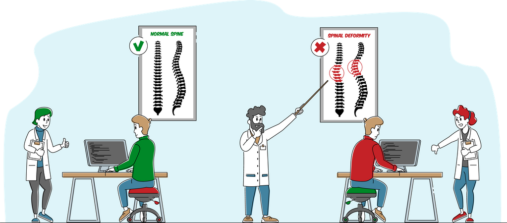 Spinal Deformity and Spine Backbone Curvature  Illustration