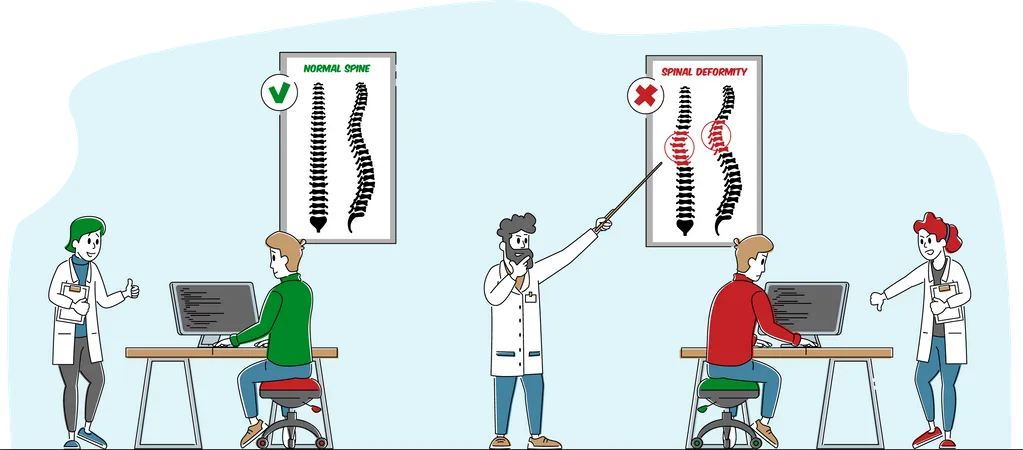 Spinal Deformity and Spine Backbone Curvature  Illustration