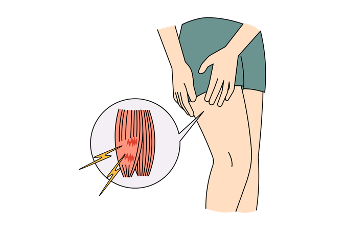 Sportsman tear leg muscle suffer from pain  Illustration