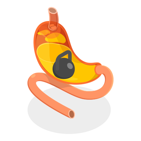 Stomach Problems  Illustration