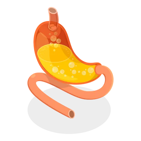 Stomach Problems  Illustration