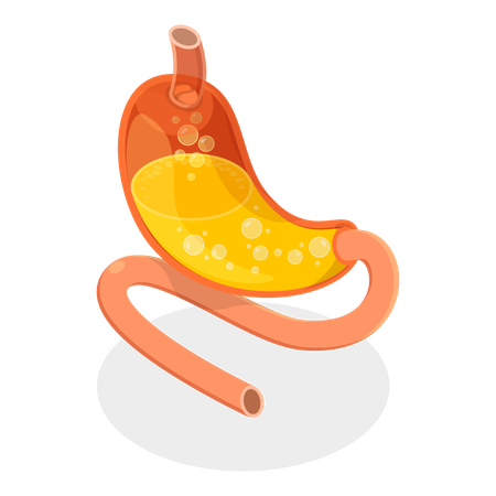 Stomach Problems  Illustration