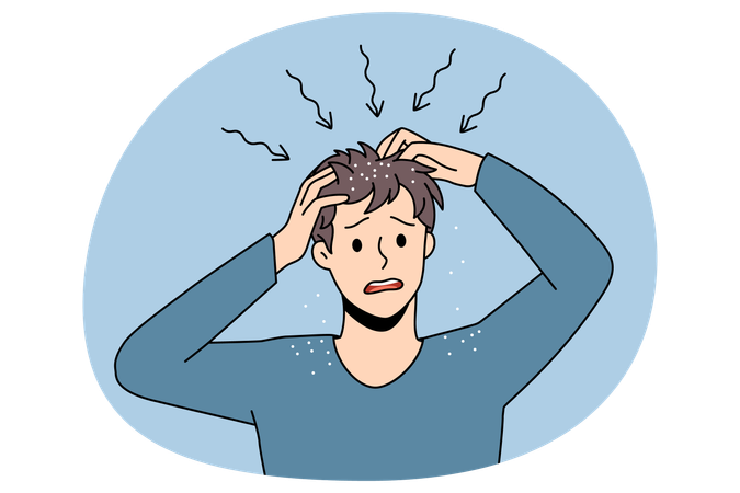 ストレスでイライラした男性が立っていて、頭皮がかゆくなり、健康上の問題を感じ、髪を掻いている。  イラスト