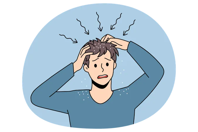 ストレスでイライラした男性が立っていて、頭皮がかゆくなり、健康上の問題を感じ、髪を掻いている。  イラスト
