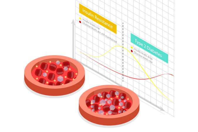 Tableau de résistance à l'insuline et de diabète de type 2  Illustration