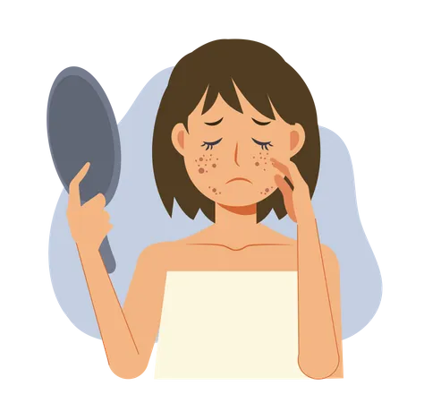 Acne Skin Problems Concept Woman Holding Mirror Is Getting Sad Due To Acne On Her Facial Flat Vecor Cartoon Character Illustration Illustration