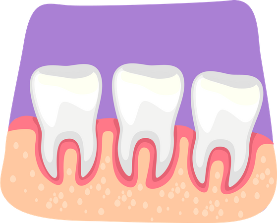Teeth inflammation Illustration