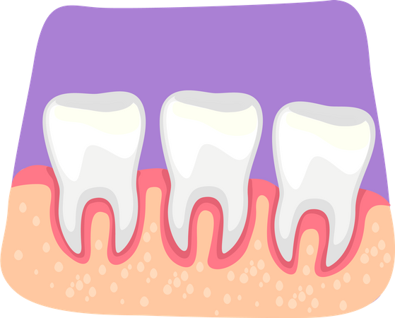 Teeth inflammation  Illustration