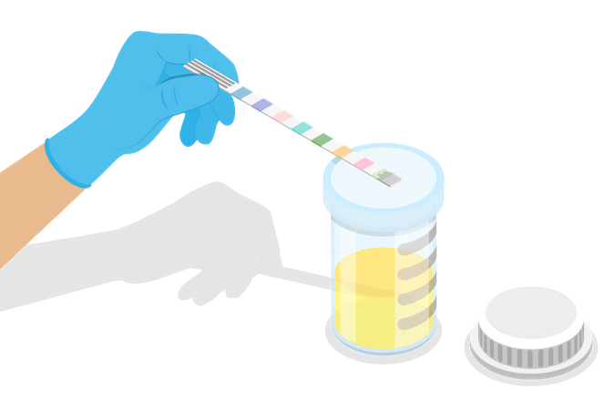 Test d'urine  Illustration