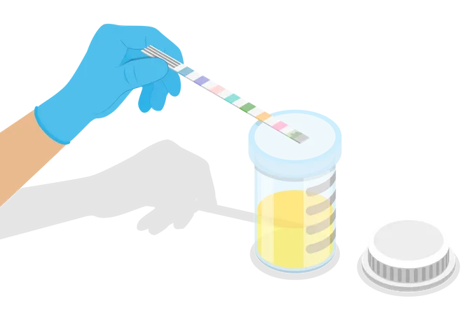 Test d'urine  Illustration