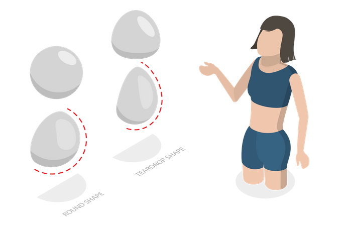Tipos de implantes mamários  Ilustração