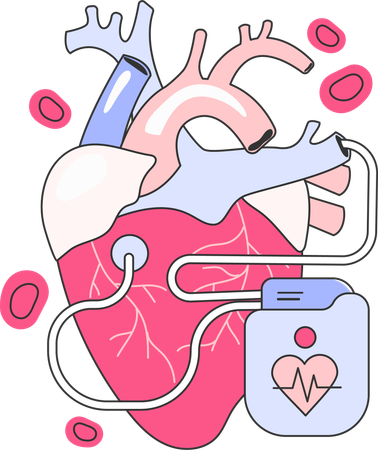 Traitement cardiaque  Illustration