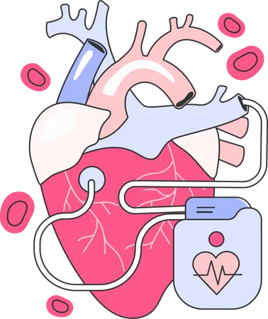 Traitement cardiaque  Illustration