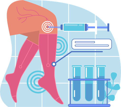 Traitement des varices  Illustration