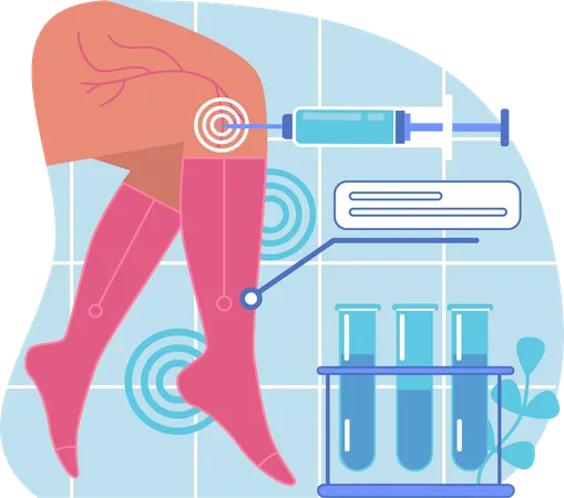 Traitement des varices  Illustration