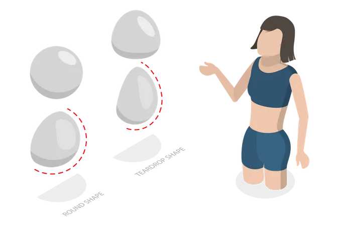 Types d'implants mammaires  Illustration