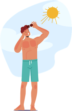 Un homme souffre d’un coup de soleil douloureux sur la plage  Illustration