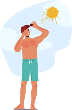 Un homme souffre d’un coup de soleil douloureux sur la plage  Illustration