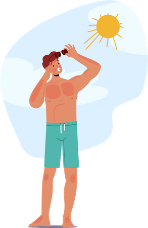 Un homme souffre d’un coup de soleil douloureux sur la plage  Illustration